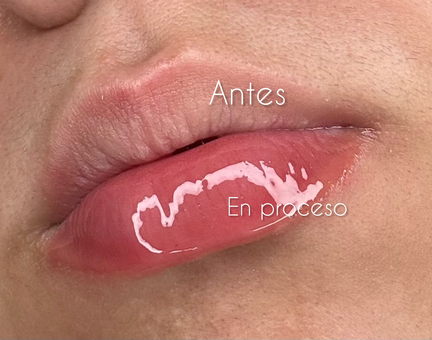 Lip Plumper RMT