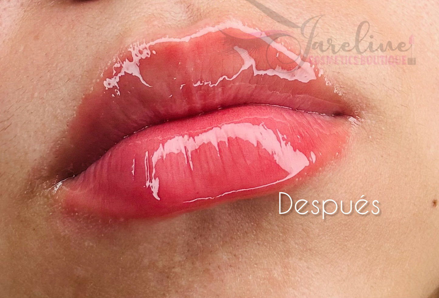 Lip Plumper RMT